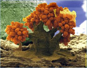 01 Myxobakterien mit so genannten Fruchtkörpern (eingefärbtes Mikrofoto) 
© Gesellschaft für B…
