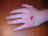8. //////////fur//// art entertainment interfaces ; Hand nach 30-minütigem Match auf PainStatio…
