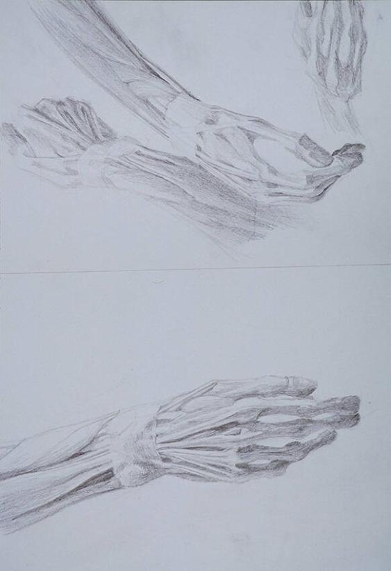 Operation einer distal intraartikulären Radiusfraktur (Handgelenkbruch)