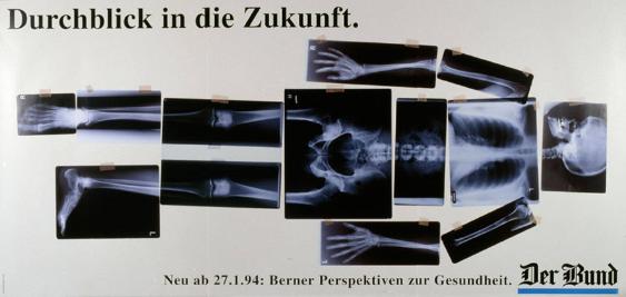 Durchblick in die Zukunft. Neu ab 27.1.94: Berner Perspektiven zur Gesundheit. Der Bund