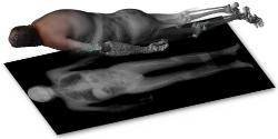 Till Sieberth, 3D Personen Dokumentation von Verstorbenen, 2021, © IRM-UZH, Till Sieberth