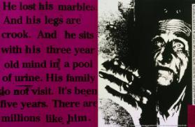 He lost his marbles. And his legs are crook. And he sits with his three year old mind in a pool of urine. His family (...) - Non smokers for the rights of smokers