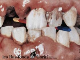 Les Bas-fond Gorki - Adaptation de Gildas Bourdet